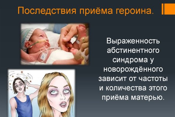Ссылка в магазин на кракен